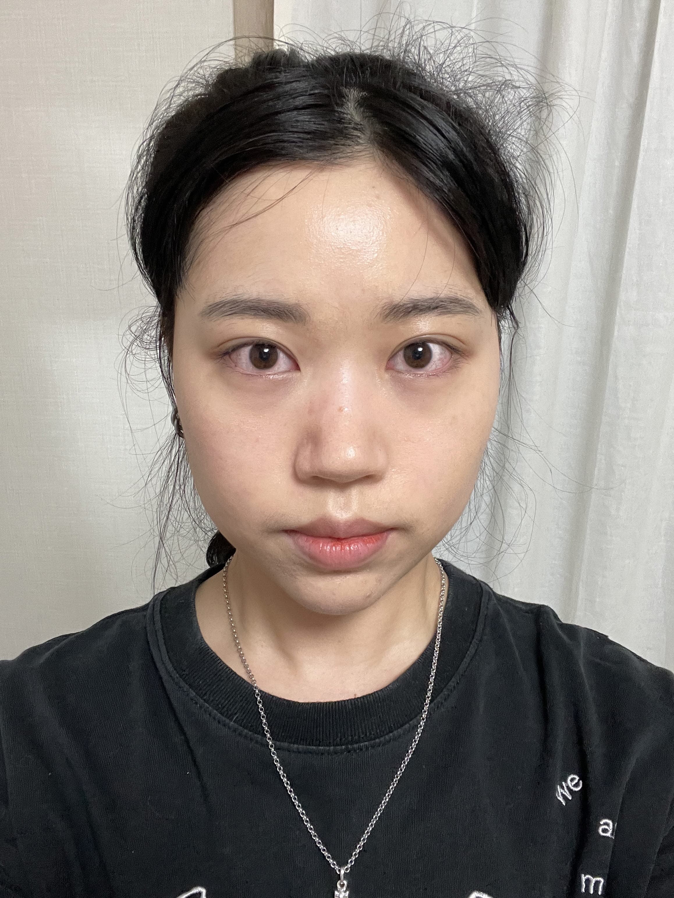 案例 5 第 2 張