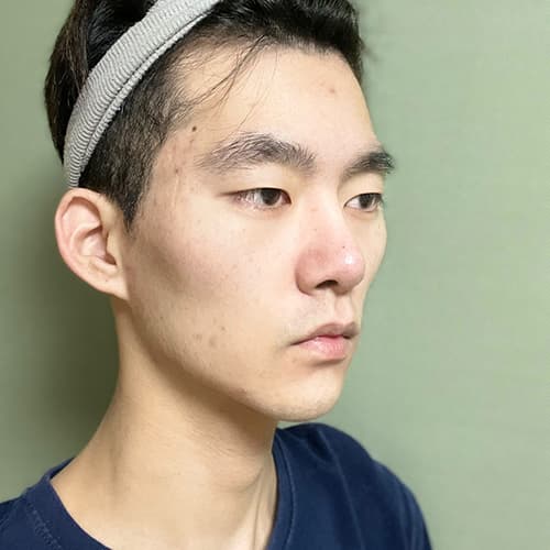 案例 13 第 4 張