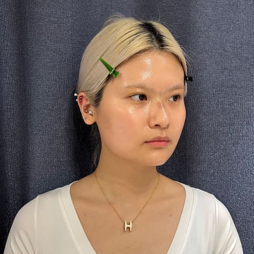 案例 20 第 3 張