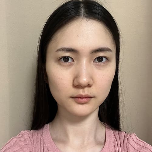 案例8 術前