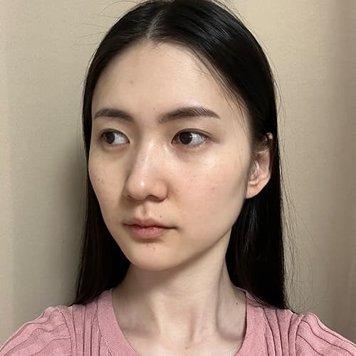案例 21 第 3 張
