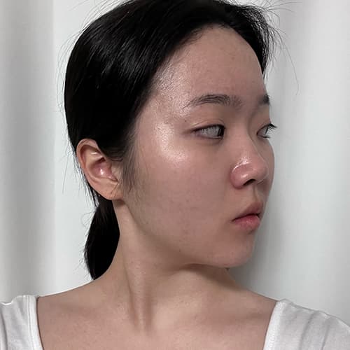案例 23 第 3 張