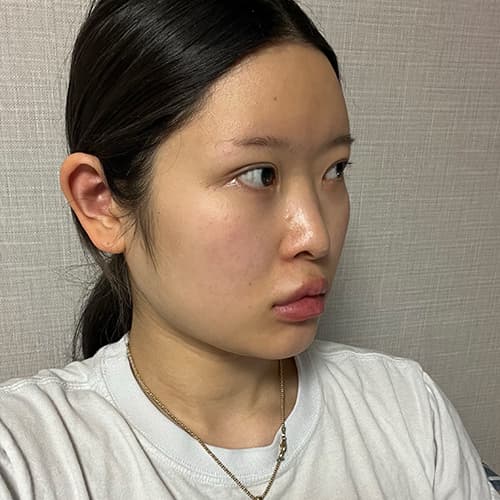 案例 24 第 3 張