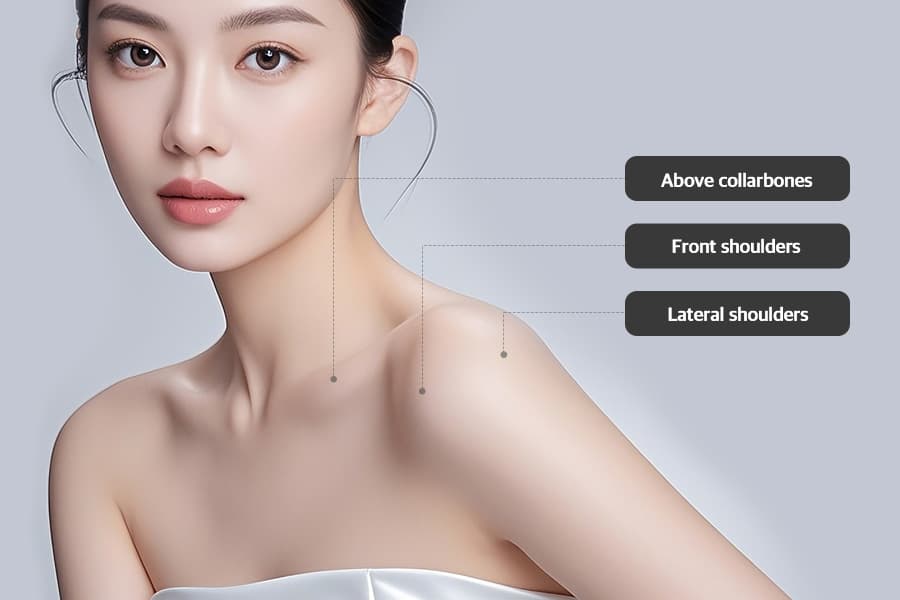 Shoulder & Collarbone Filler
