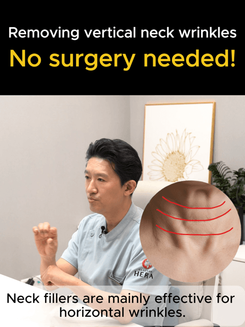 Say goodbye to vertical neck wrinkles—WITHOUT surgery! 🙅♀️✨ Vertical neck lines used to be the hardest to treat, often needing a surgical neck lift. But the trend has changed NOW Introducing the CaHA Skin Booster treatment! 💉 By spreading diluted calcium filler evenly under the vertical folds, we stimulate your skin to regain its firmness and bounce naturally. Perfect for ✅ Loss of skin elasticity ✅ Deep vertical neck bands ✅ Those wanting surgical results without the downtime The future of neck rejuvenation is here at Gangnam Hera. 🤍